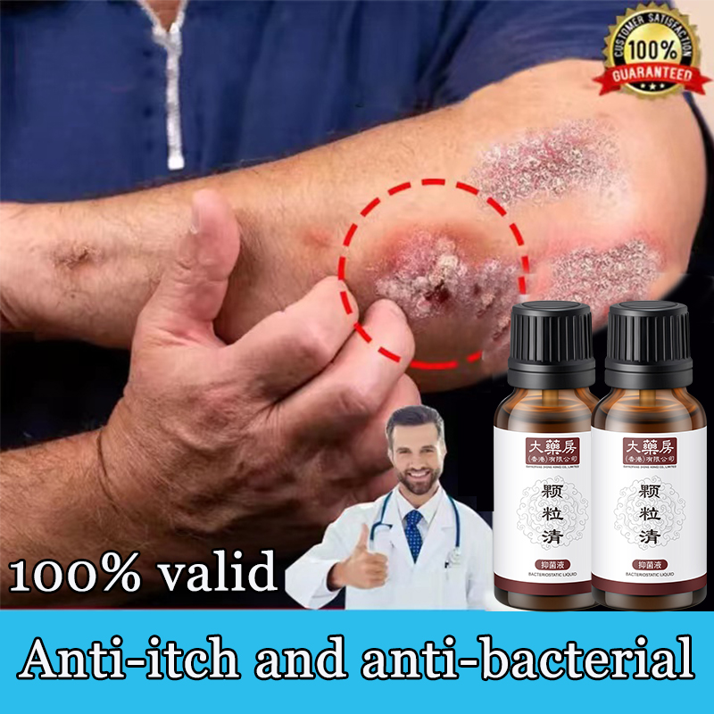 ??Hot in Hong Kong?? Antibacterial liquid 20ML Itchy Feet Hand Foot Care Nail Fungus Treatment Remove Dead Skin Beriberi Calluses Cracked Feet Foot Treatment Exfoliating Specialize in beriberi odor